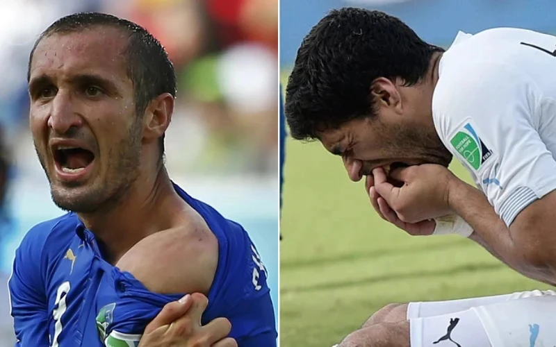 luis-suarez-muestra-los-dientes luis-suarez-muestra-los-dientes